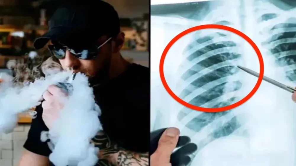 Uzmanlardan E-Sigara Uyarısı: “Zararsız Değil, Gizli Tehlike!”