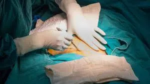 Siirt’te İlk Kez “Alexis C-Section” Tekniği ile Sezaryen Yapıldı